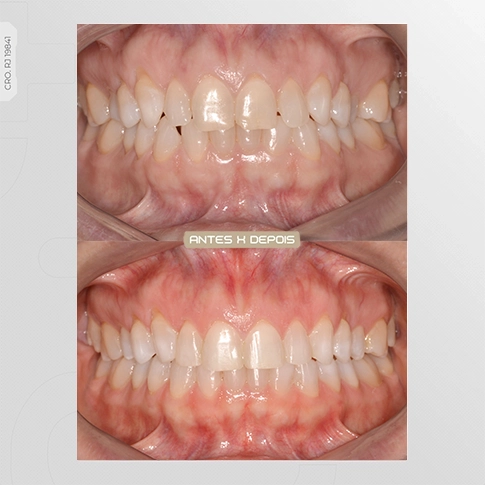 Sem-Titulo-2111 copiar